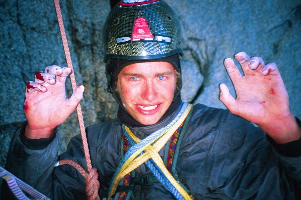 Skrekken: Leo innser at han ikke er udødelig, og er samtidig åndsnærværende nok til å be kompisen ta et bilde kort etter at han falt 15-20 meter og ødela ankelen, 300 meter opp på Østveggen av Cerro Torre, 16. februar 2002. Foto: Kevin Thaw Leo-Houlding-Klatring-3