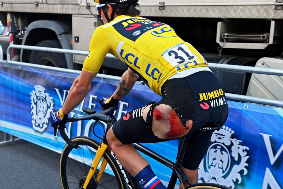 BLODIG: Slik så Primoz Roglics skinke ut etter den første velten på etappen. Foto: Cor Vos primoz roglic velt paris-nice 2021